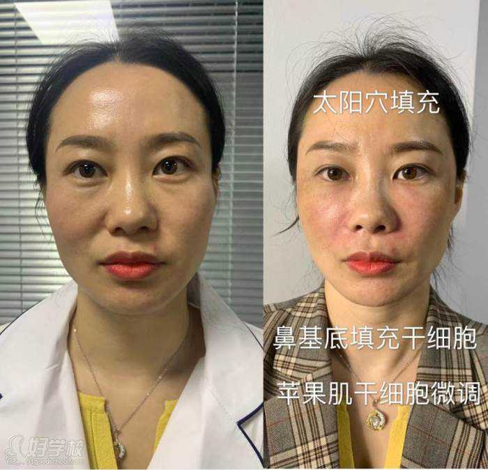 北京亦庄细胞治疗研发中试基地项目已进入收尾阶段