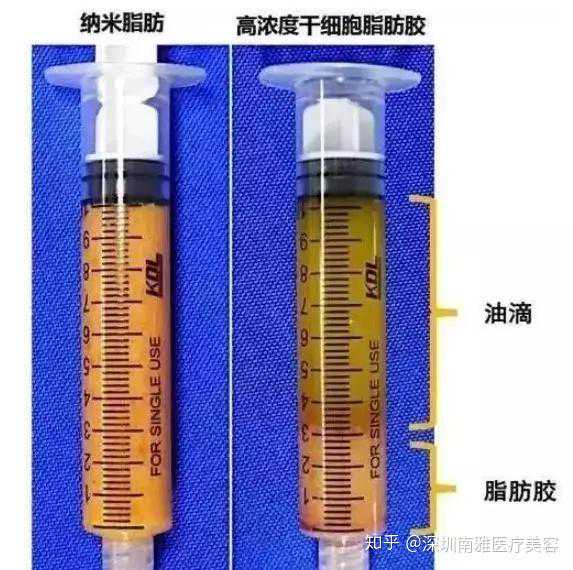 血小板减少症的预防很关键,要如何预防血小板减少症?