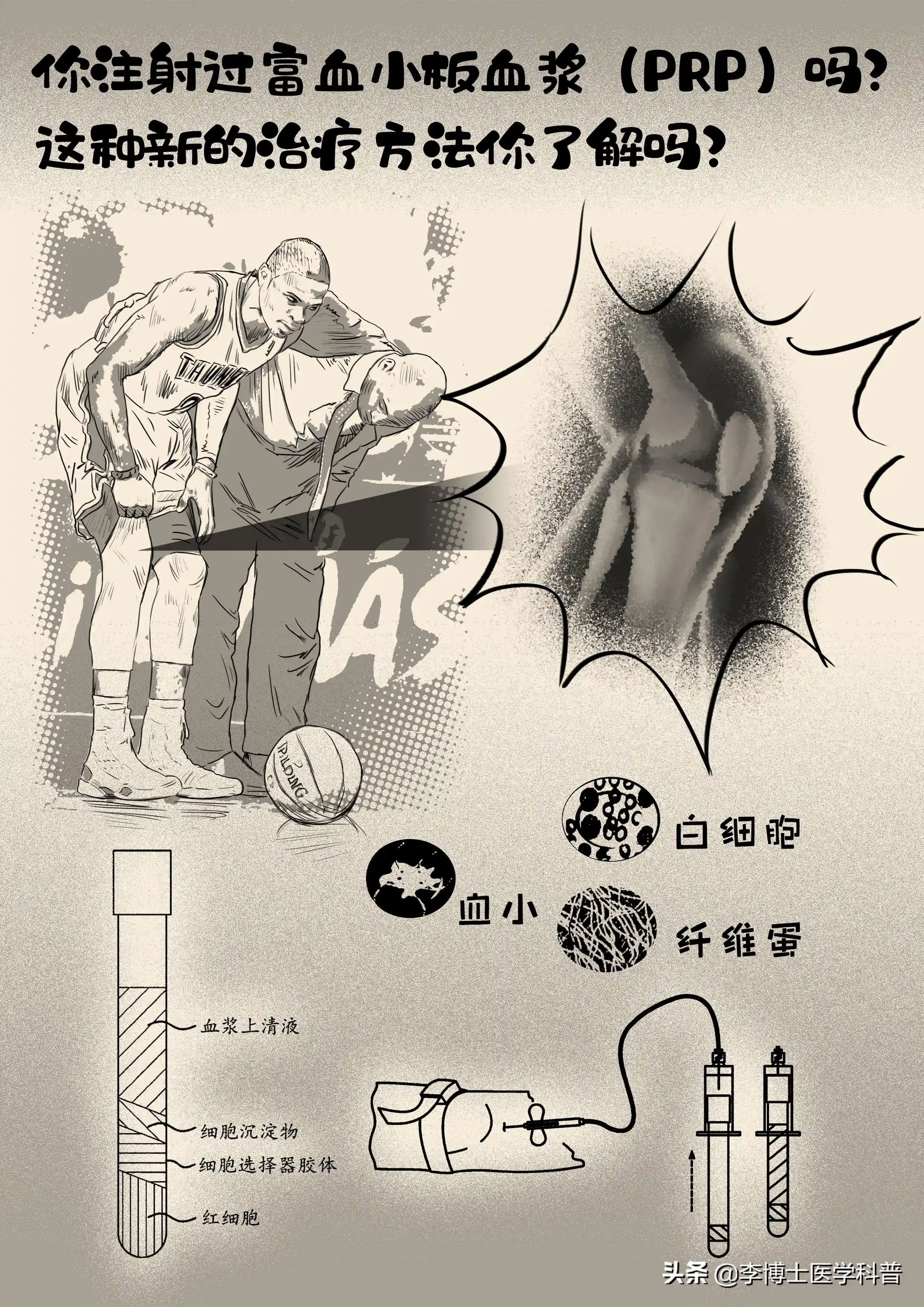 你注射过富血小板血浆（PRP）吗？这种新的治疗方法你了解吗？