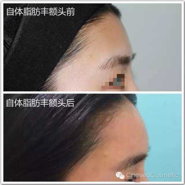 鲁皖两省爱心接力 24岁女孩收获“生命种子”