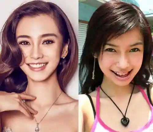 女为知己者 整形还是美容？